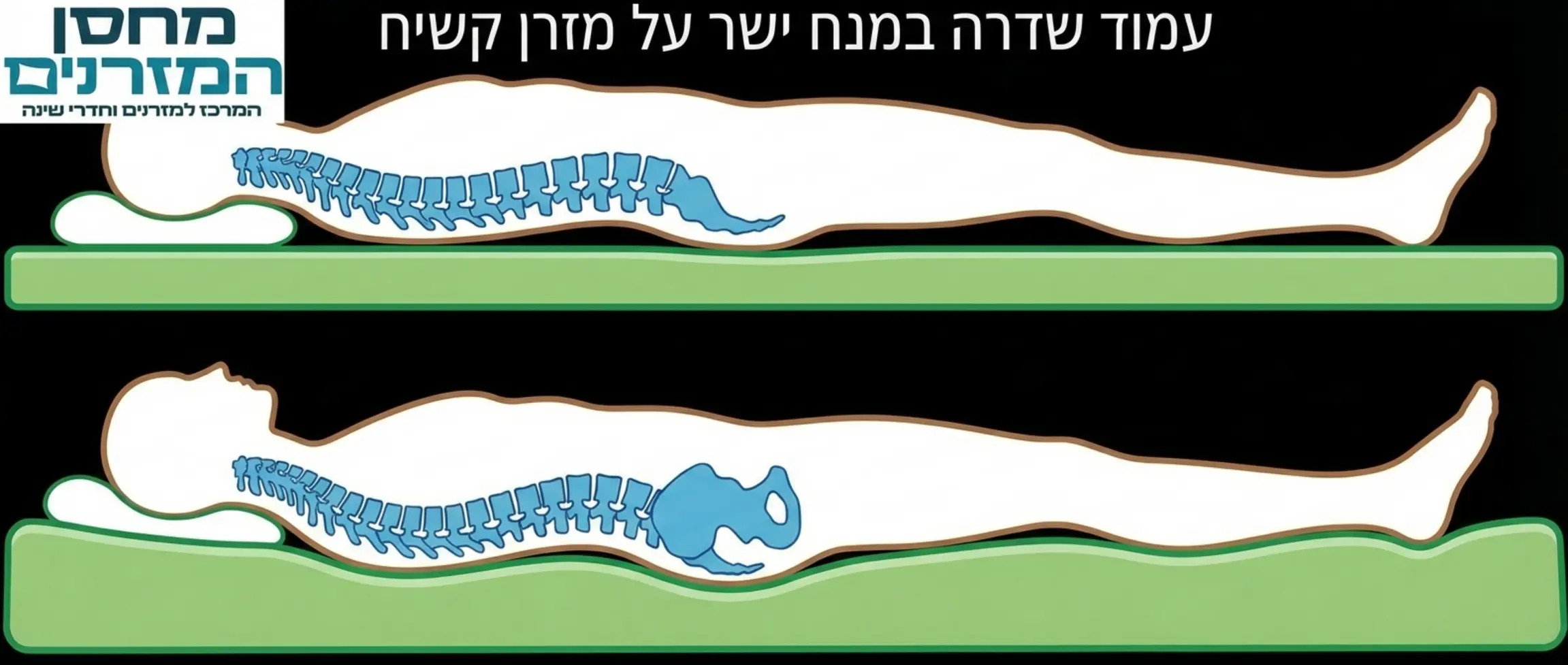 איור גרפי הממחיש את עמוד השדרה במבט צד. בחלק העליון רואים עמוד שדרה ישר על מזרן קשיח, ובחלק התחתון רואים עמוד שדרה מעוקל בצורת קשת כלפי מטה על מזרן רך שבו האגן שוקע