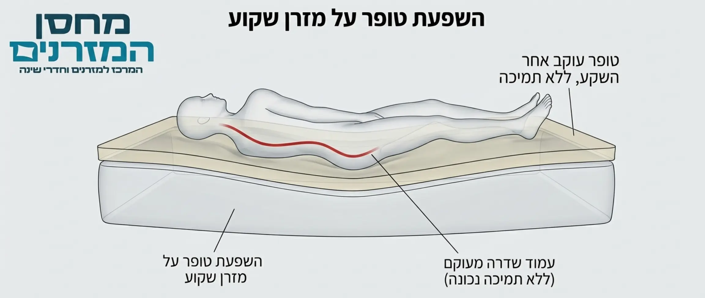 תרשים תלת ממדי הממחיש אדם השוכב על מזרן שקוע במרכזו ועליו טופר. התרשים מדגים בבירור כיצד הטופר מקבל את צורת השקע ולא פותר את בעיית חוסר התמיכה בעמוד השדרה