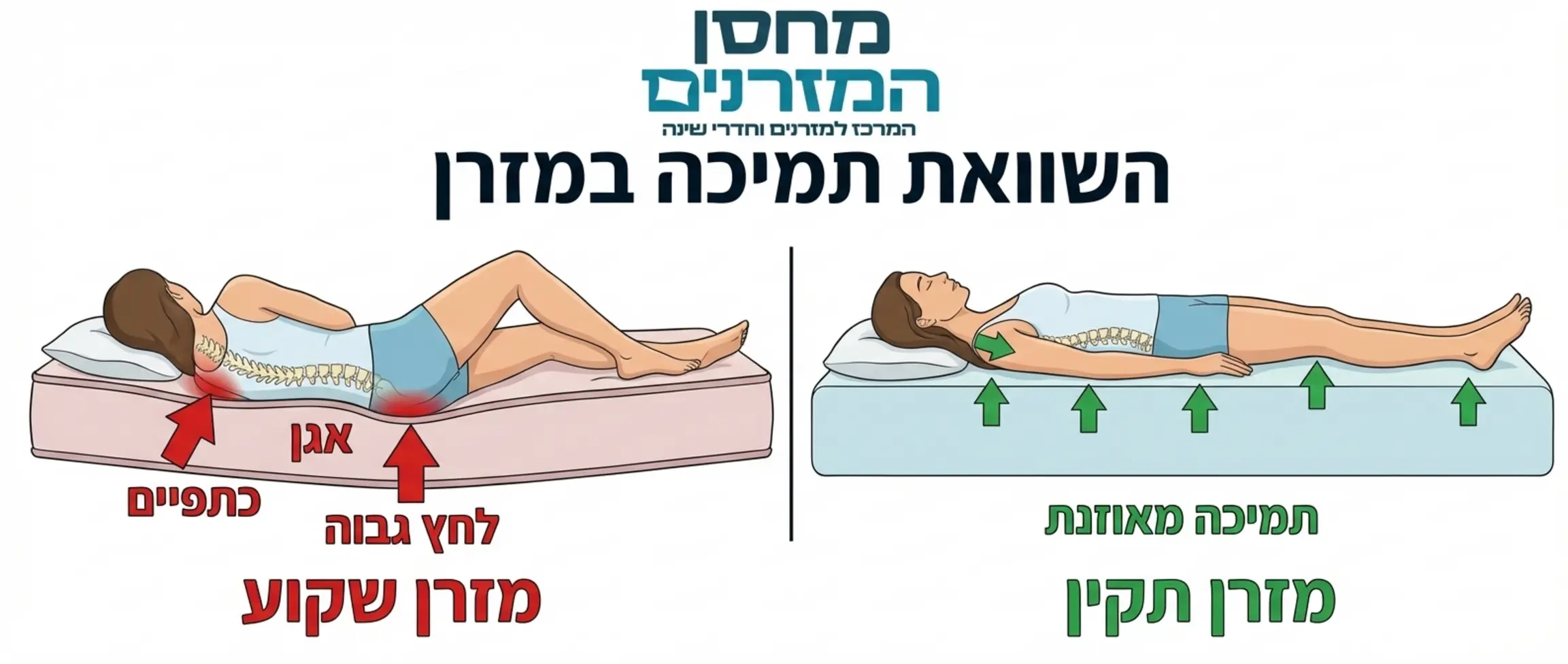 אינפוגרפיקה המציגה חתך צד של מזרן שקוע לעומת מזרן תקין, עם חצים המראים את אזורי הלחץ באגן ובכתפיים
