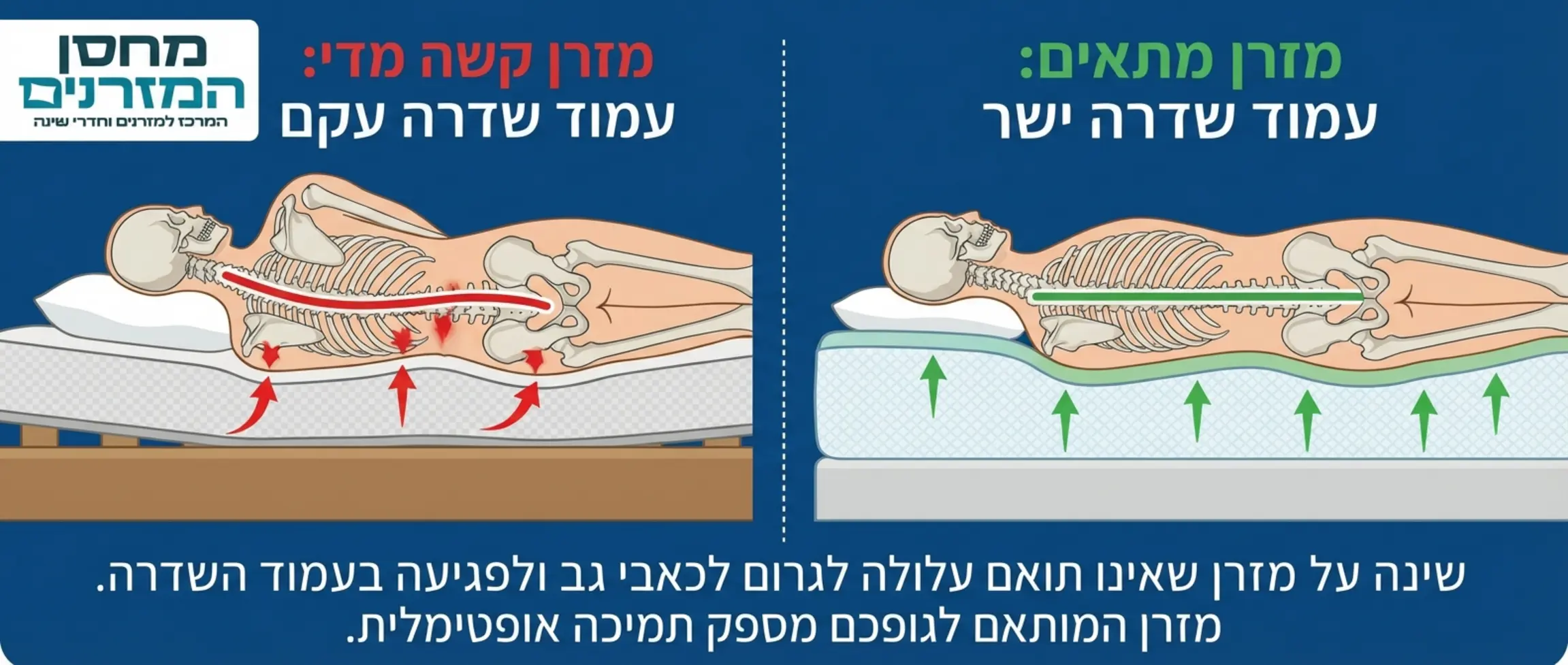 איור גרפי המציג שלד של אדם הישן על הצד על מזרן קשה מדי, כאשר עמוד השדרה עקום, לעומת איור של אדם על מזרן מתאים בו עמוד השדרה ישר